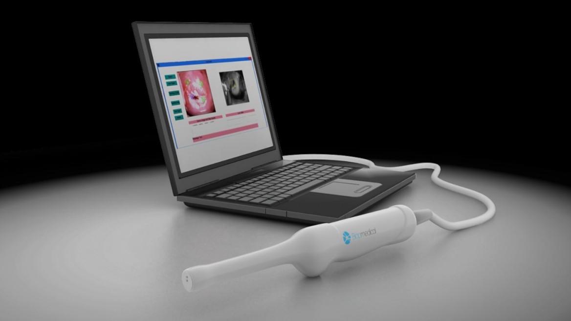 Biop Medical está diseñando un colposcopio para detectar cáncer cervical. Foto cortesía.