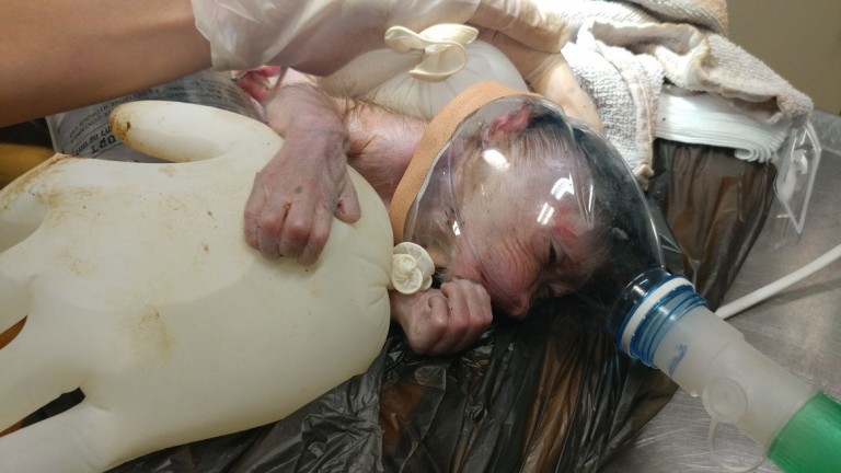 La cría, nacida el 9 de enero, se aferra a un guante quirúrgico inflado mientras recibe tratamiento. Cortesía del Centro Zoológico de Tel Aviv-Ramat Gan Safari.